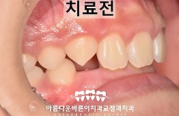 수술전
