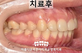 수술후