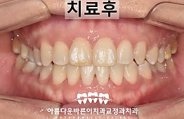 수술후