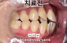 수술전