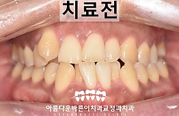 수술전