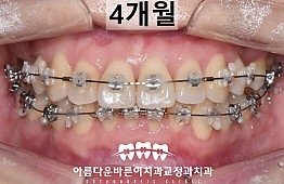 수술후