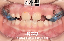 수술후