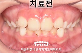 수술전