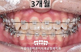 수술후