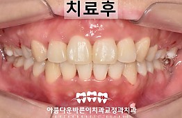 수술후