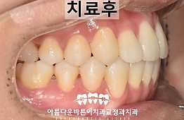 수술후