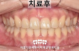 수술후