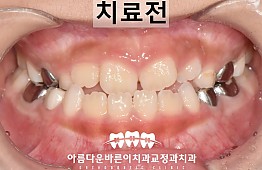 수술전