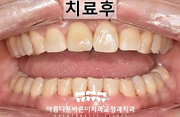 수술후