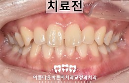 수술전