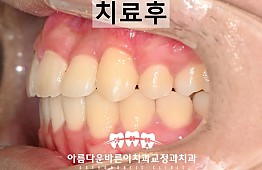 수술후
