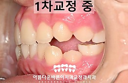수술후
