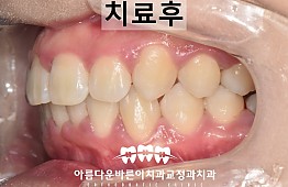 수술후