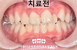 수술전