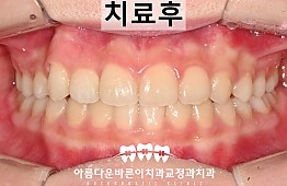 수술후