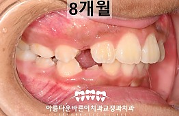 수술후