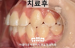 수술후