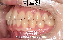 수술전