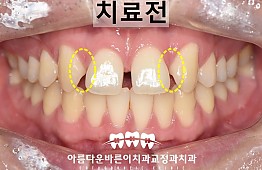 수술전