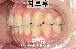 수술후