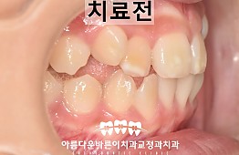 수술전