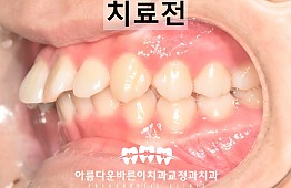 수술전