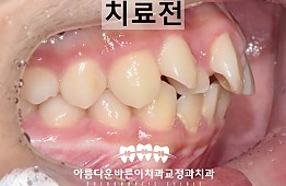 수술전