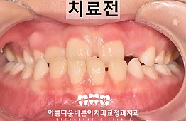 수술전