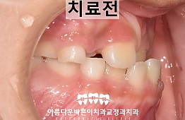 수술전