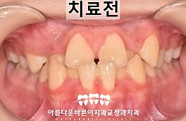 수술전