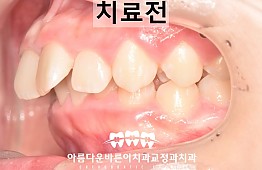 수술전