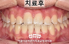 수술후