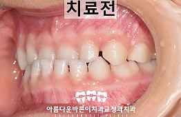 수술전