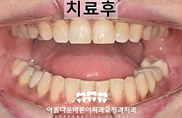 수술후