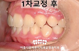 수술후