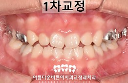 수술후