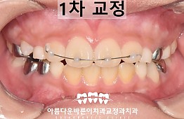 수술후