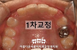 수술후