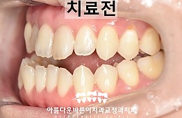 수술전