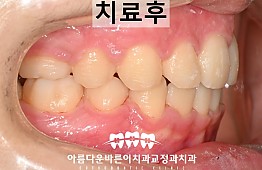 수술후