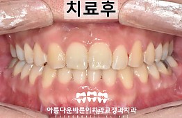 수술후