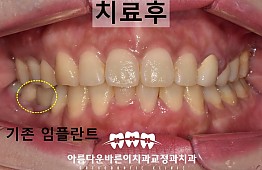 수술후