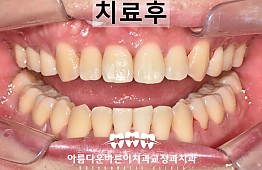 수술후