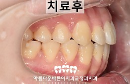 수술후