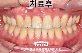 수술후