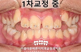 수술후