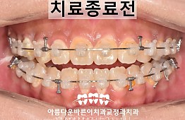 수술후