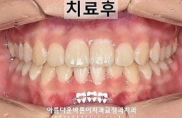 수술후