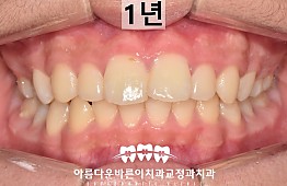 수술후